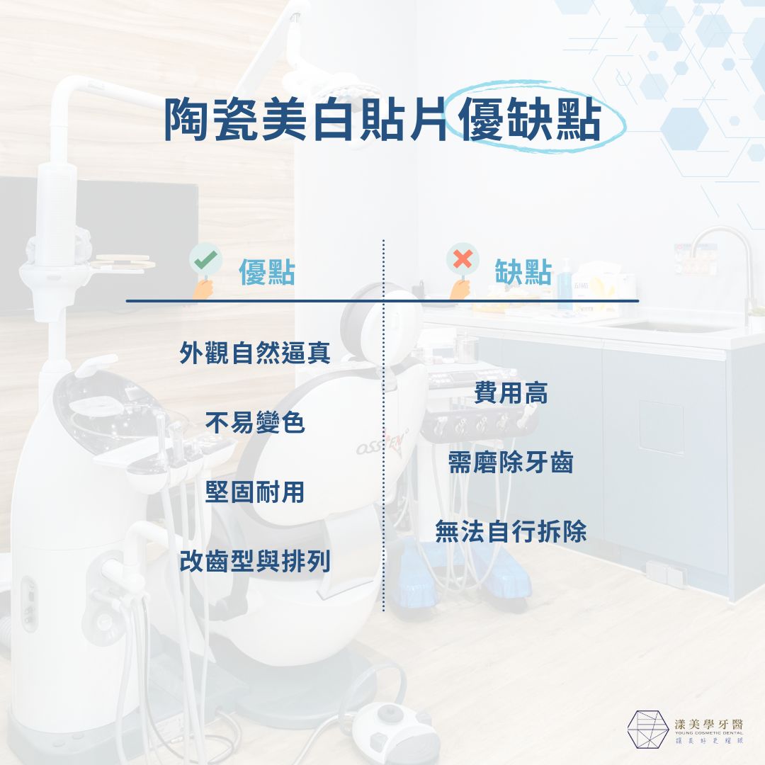 陶瓷美白貼片優缺點
