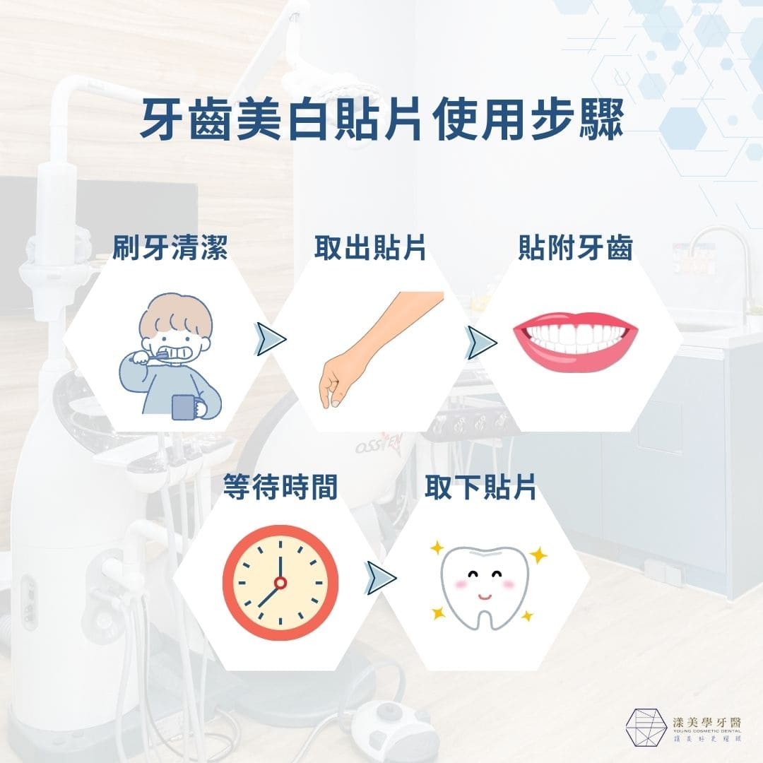 牙齒美白貼片真的有效嗎?使用方法、優缺點與價格全解析! 1 牙齒美白貼片使用步驟