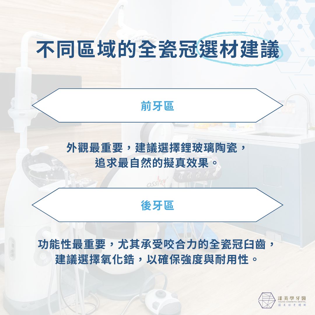 不同區域的全瓷冠選材建議