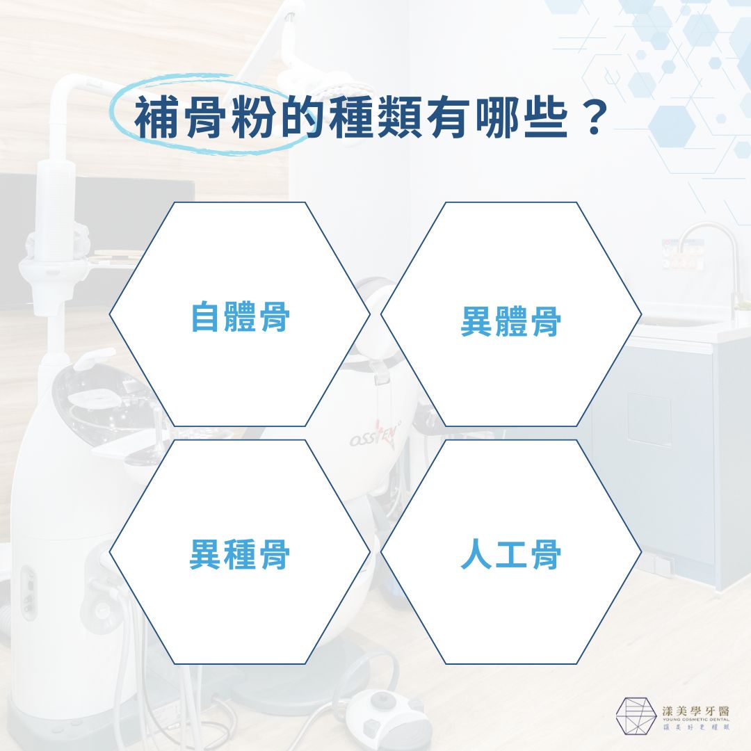 植牙補骨粉一定要做嗎?你該知道的補骨關鍵知識 1 補骨粉的種類有哪些?