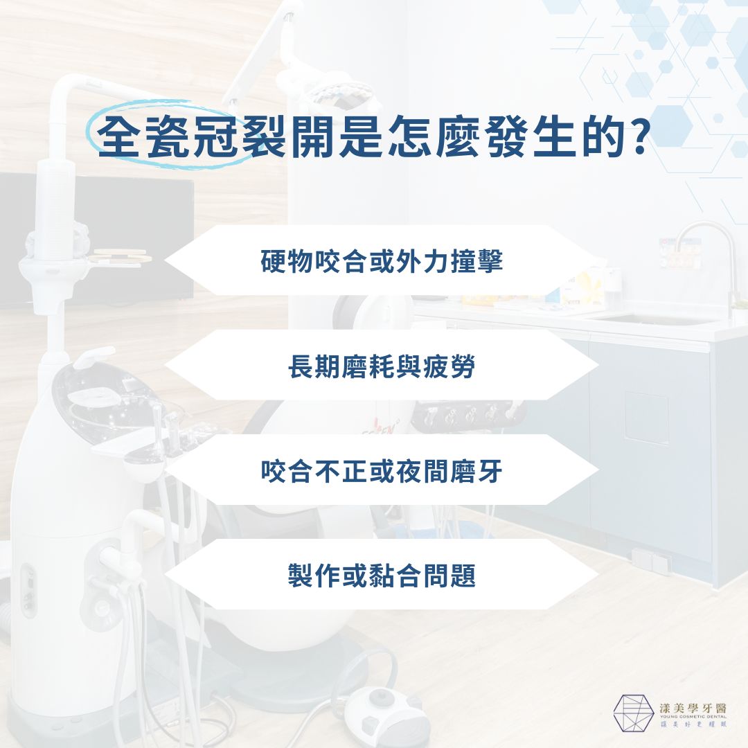 全瓷冠裂開是怎麼發生的?