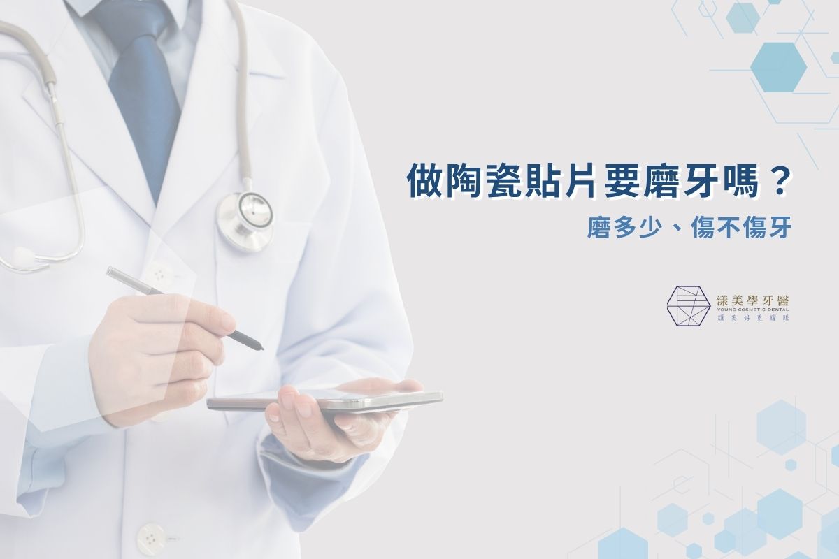 最新消息 2 做陶瓷貼片要磨牙嗎?磨多少、傷不傷牙